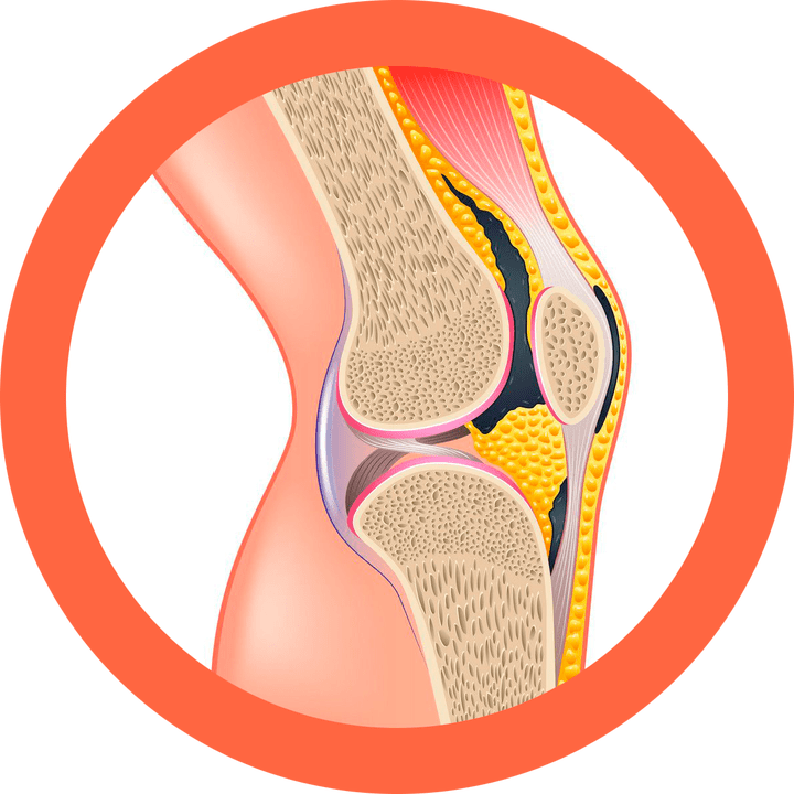Hondroten ripristina articolazioni e muscoli